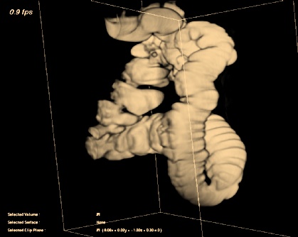 colon-3D.jpg